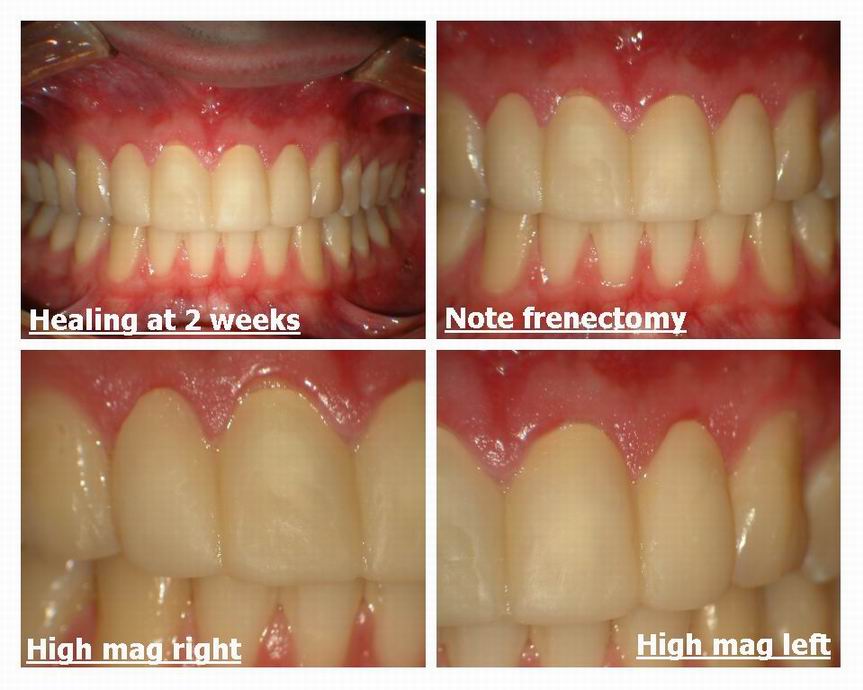 Resize of Crown insertion Derek Delong pg 1.jpg